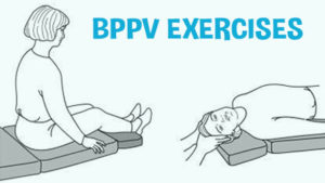 BPPV Exercises For Recovering From Vertigo | Cure Vertigo Now